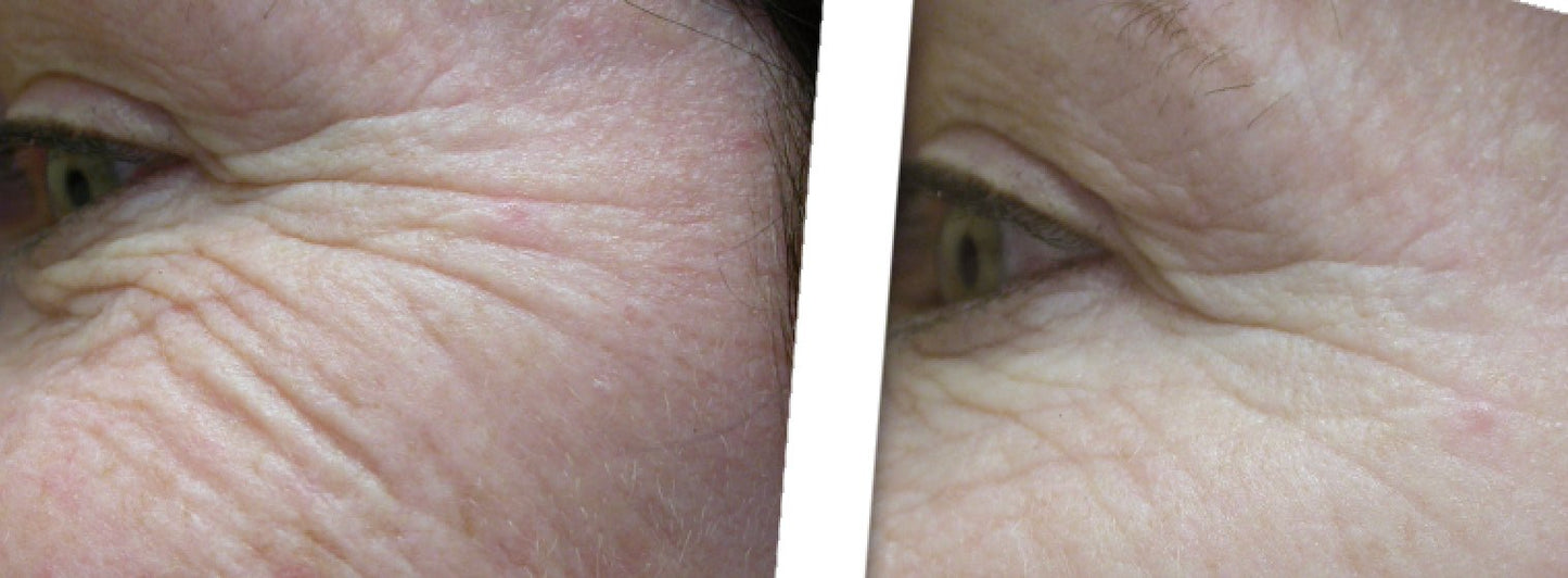 Onassis Contoured Eye Ceam - ONASSIS SKIN