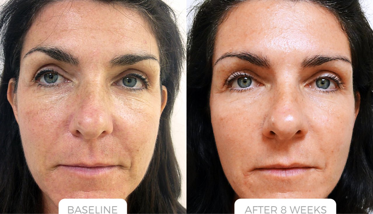 ONASSIS STEM CELL SERUM - ONASSIS SKIN