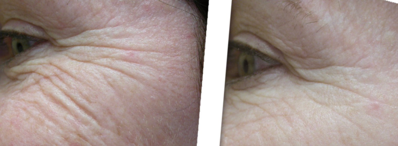 Onassis Contoured Eye Ceam - ONASSIS SKIN
