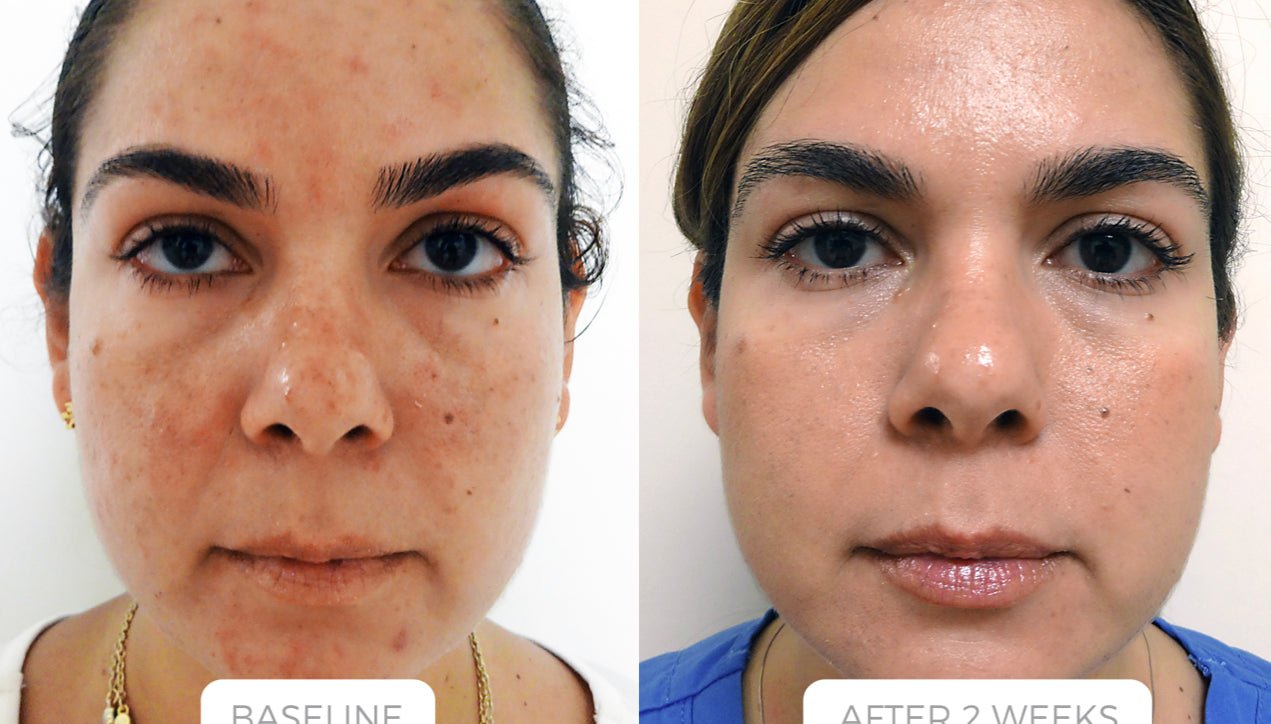 ONASSIS STEM CELL SERUM - ONASSIS SKIN